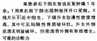 a牙源性中央性颌骨骨髓炎 b牙源性边缘性颌骨骨髓炎 c骨纤维异常增殖