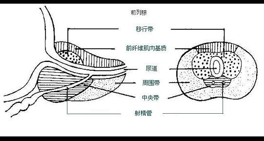 前列腺移行区图片